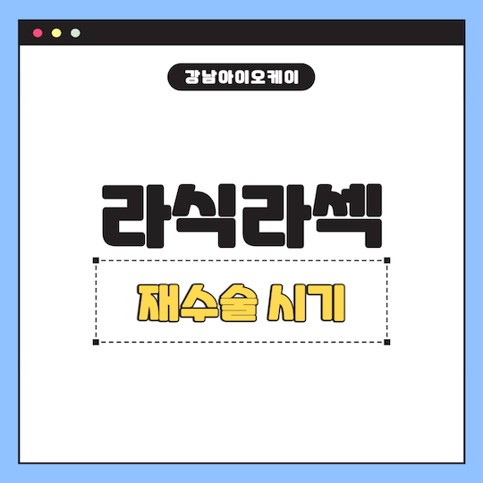 라식라섹-재수술-시기