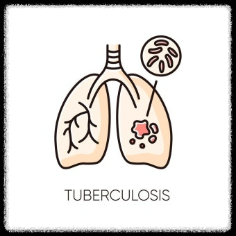결홱의 증상과 전염성