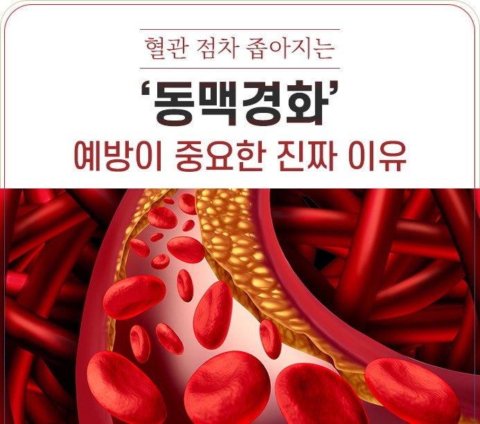 죽상 동맥경화·고혈압 예방을 위한 혈관 건강 관리