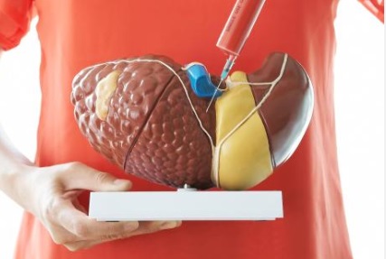 건강한 간을 유지하는 방법