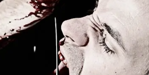 위암 초기증상 30