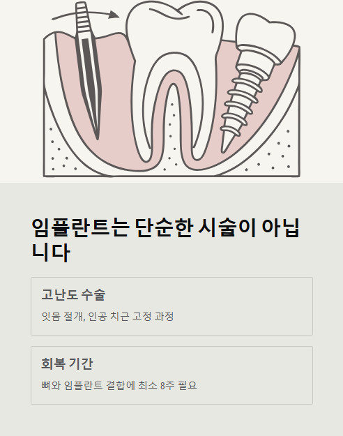 임플란트는 단순한 시술이 아닙니다