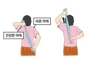 오십견스트레칭