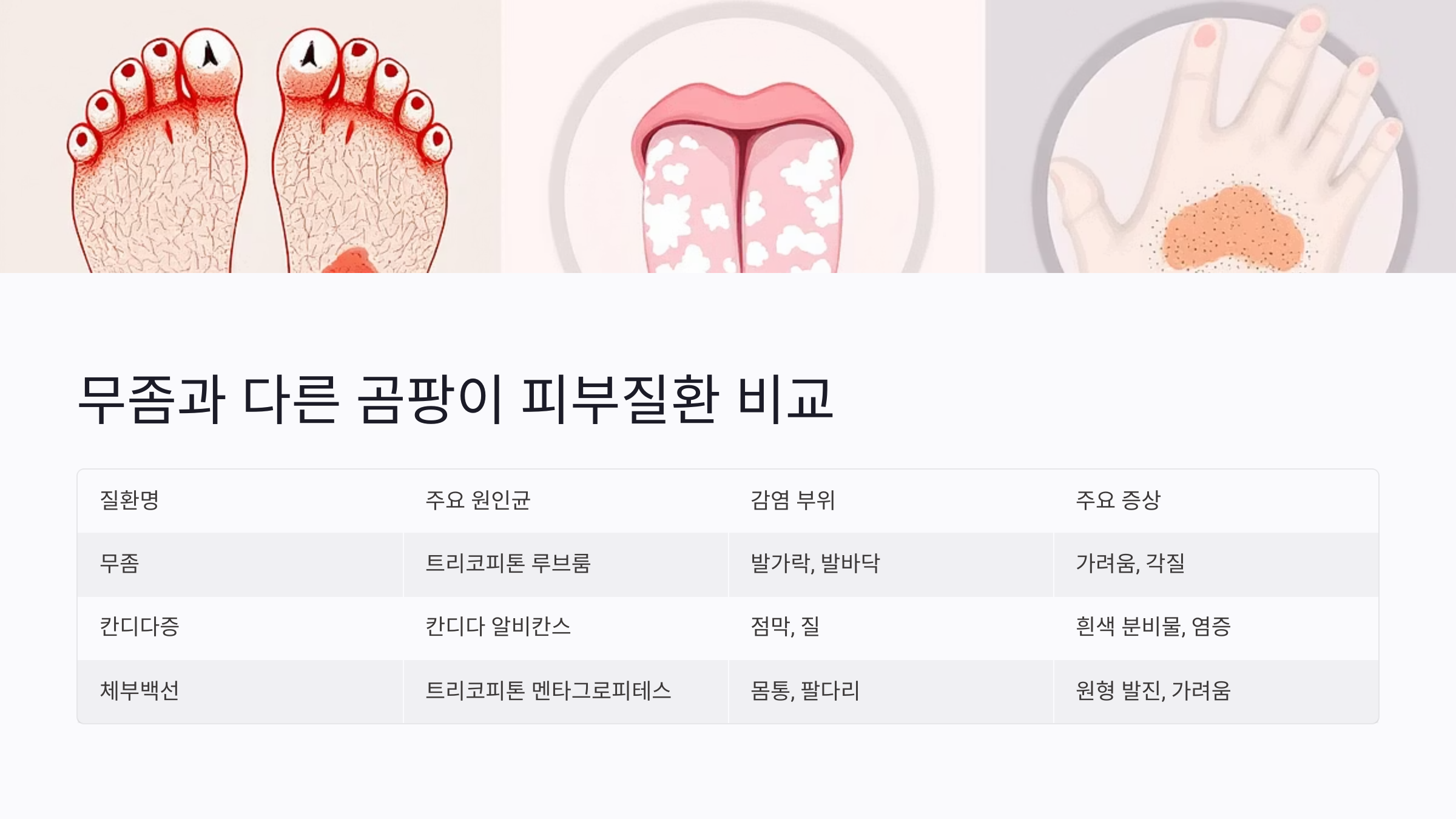 곰팡이균이 번식하는 환경 조건