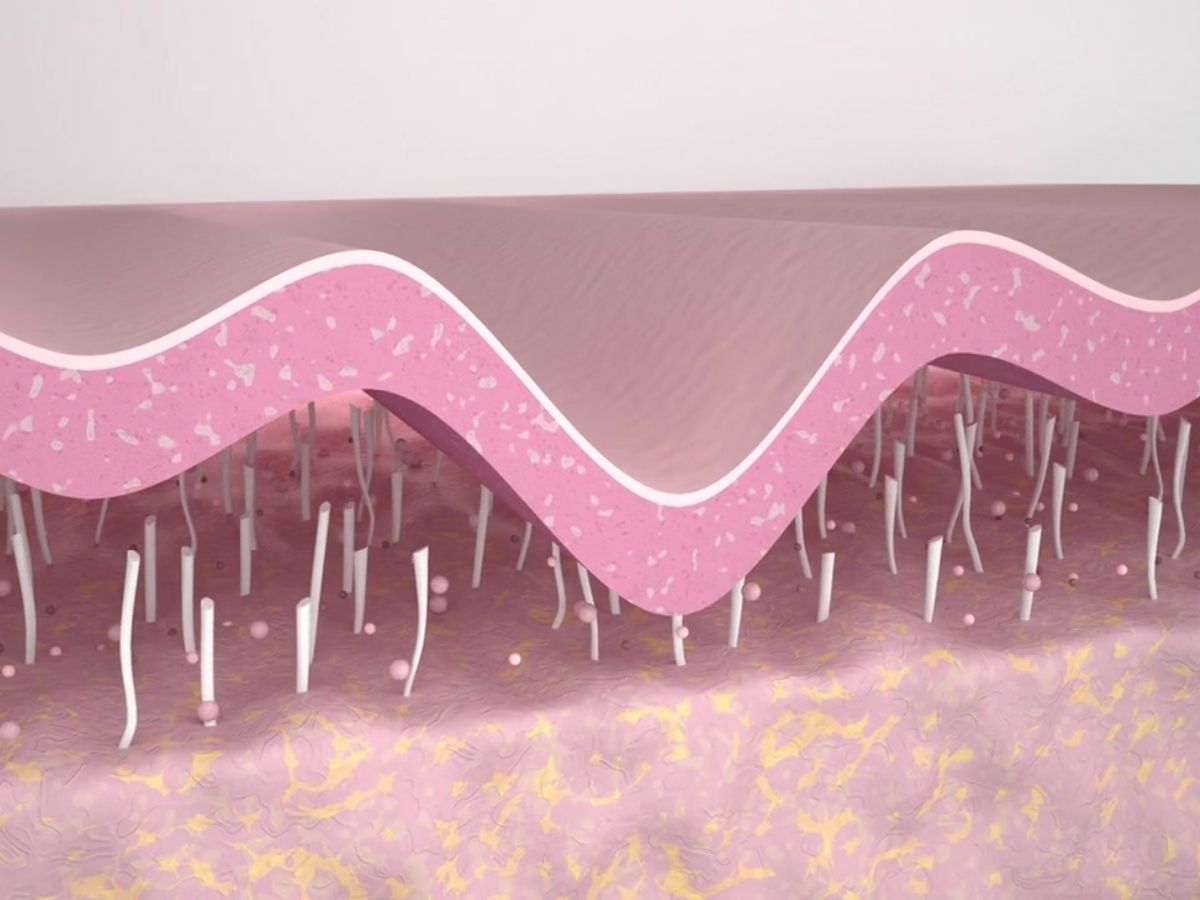 비절개 안면거상 효과