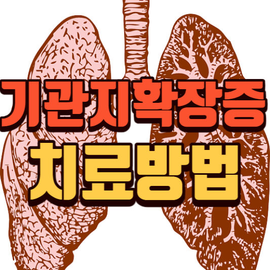 기관지확장증치료-원인-증상