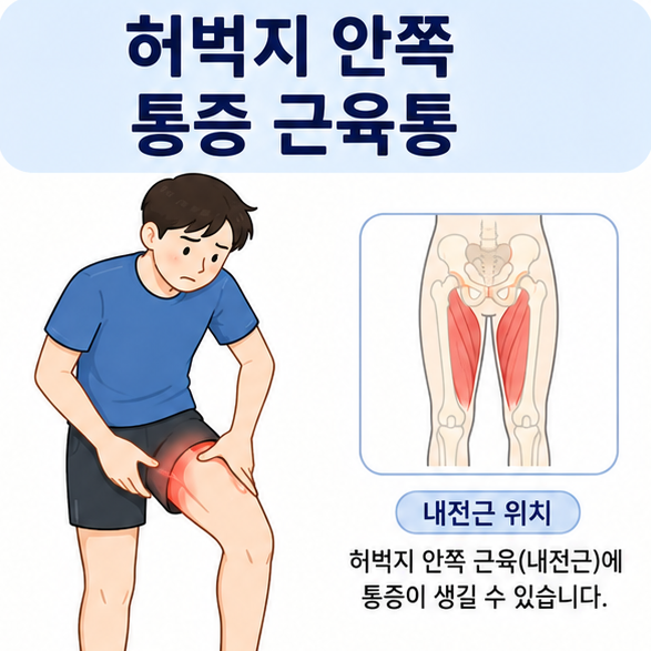 허벅지 안쪽을 가리키는 인물과 내전근 위치를 함께 보여주는 허벅지 안쪽 통증 설명 이미지