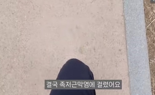 족저근막염