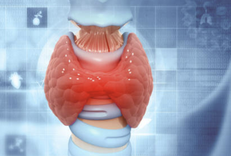 갑상선 기능 저하증 증상 좋은음식 수치 총정리(최신)