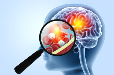 창의적 문제 해결의 심리학