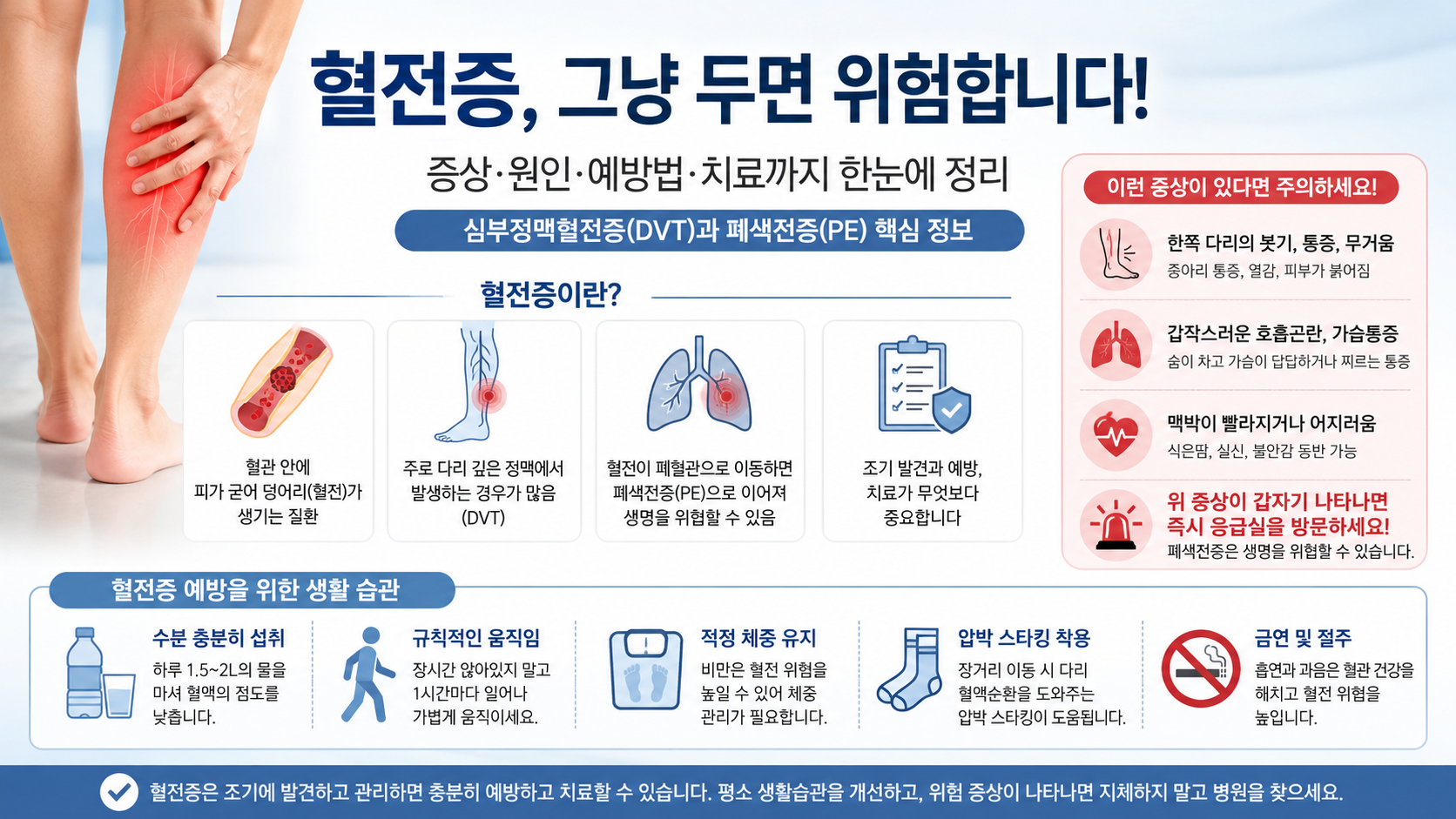 혈전증 예방 생활습관｜오래 앉아 있는 사람이라면 꼭 확인할 기준