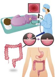 대장내시경 비용 총정리