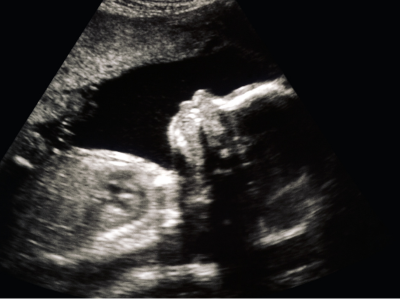 2025 새마을금고 아기뱀 적금 이자 계산 특판 적금 총정리