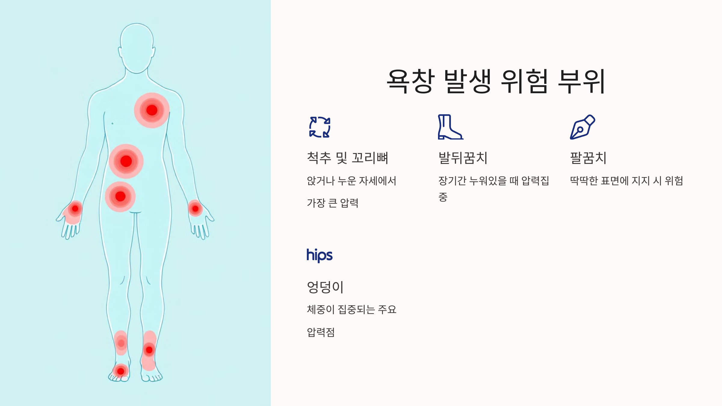 욕창 발생 위험 부위