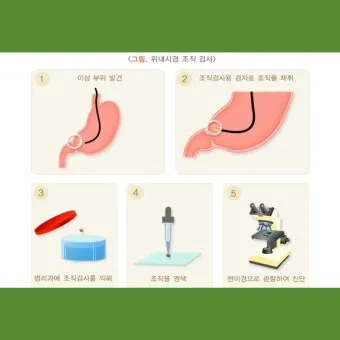 위내시경 금식시간 전날 음식 꼭 알아야 할 주의사항_18