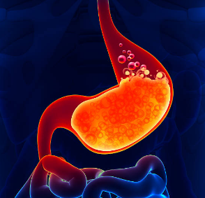 역류성 식도염에 좋은 음식&amp;#44; 증상&amp;#44; 자연치료 방법 총정리 (2024ver)