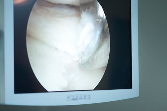 발목 인대 파열 내시경 치료 &ndash; 효과와 절차