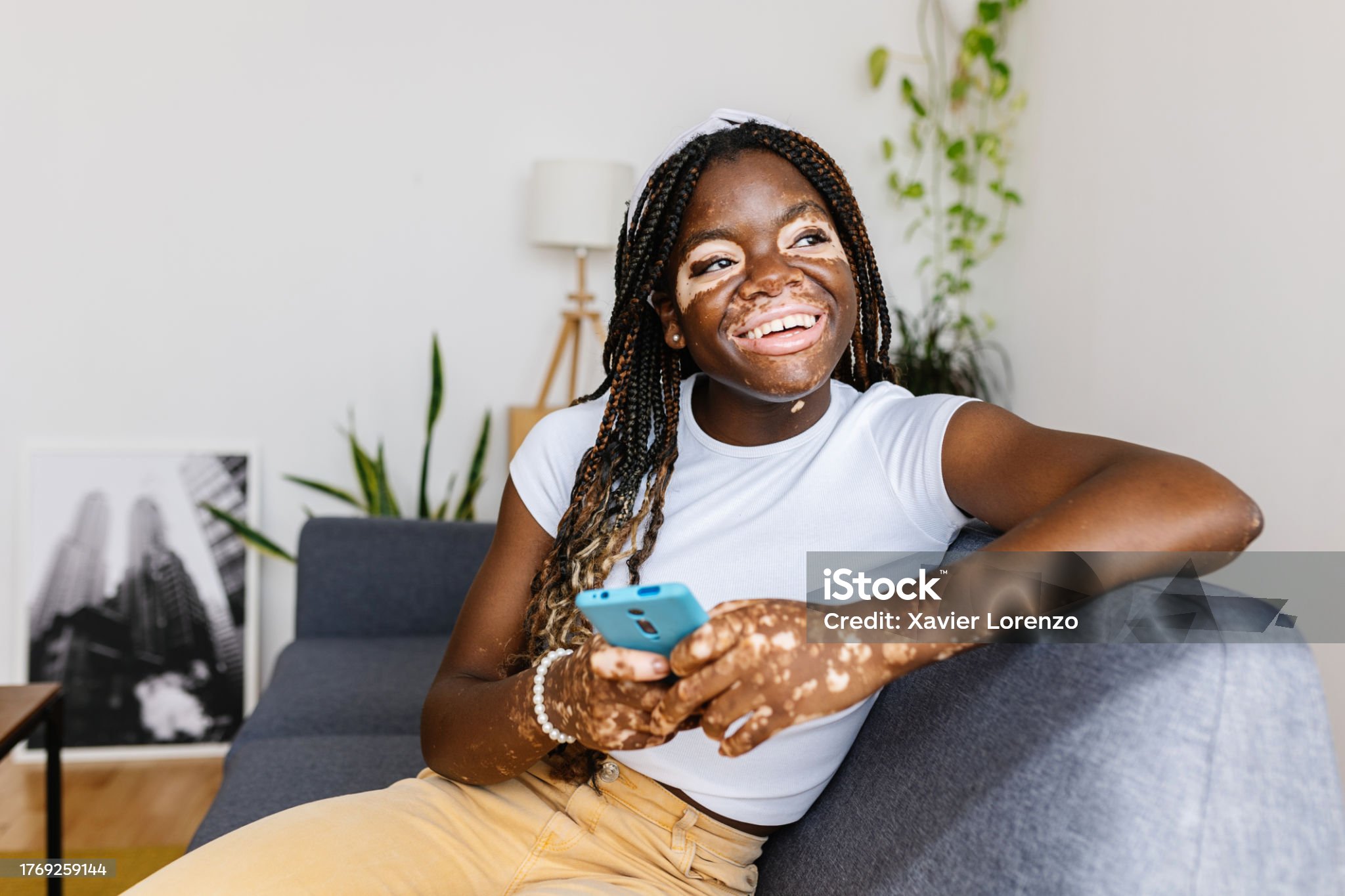 얼굴과 손에 하얀색 점이 있는 흑인 여성