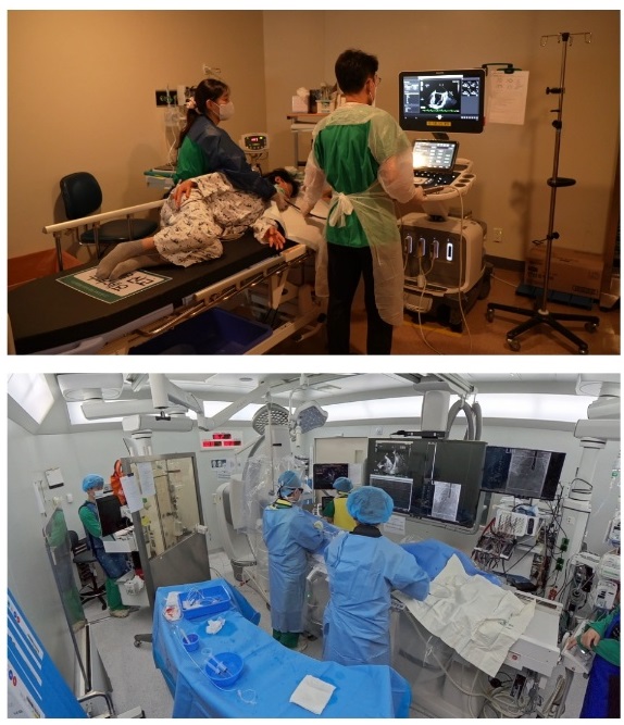 생로병사의비밀-뇌졸중-휴대용-심전도기기