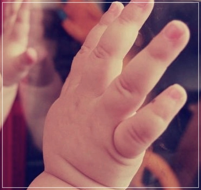 왜 손톱이 거스러질까? : 이유, 원인과 해결방법.