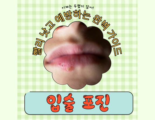 입술 포진, 이제는 두렵지 않아! 빨리 낫고 예방하는 완벽 가이드