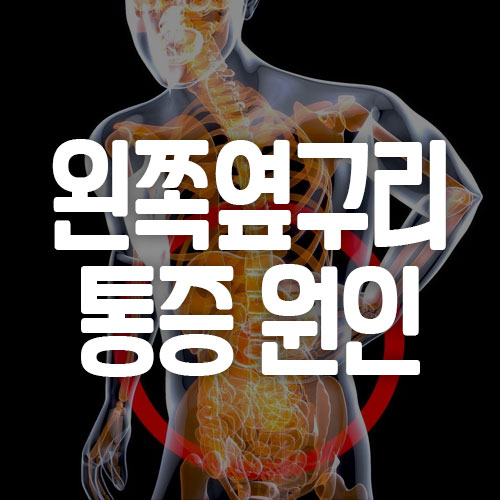 왼쪽 옆구리 통증 원인