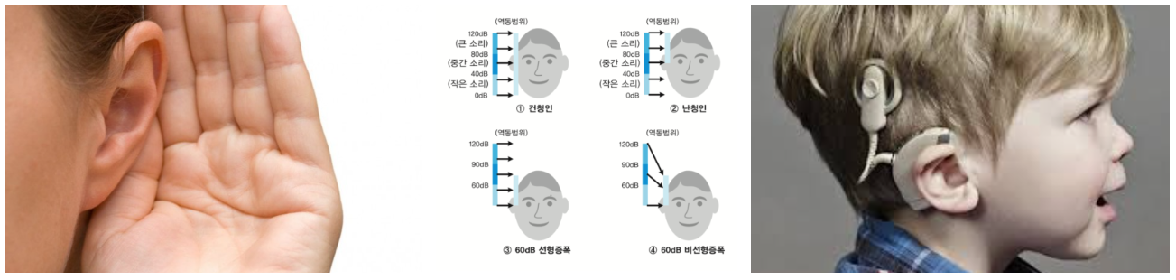 청각장애