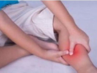 종아리-근육파열-증상