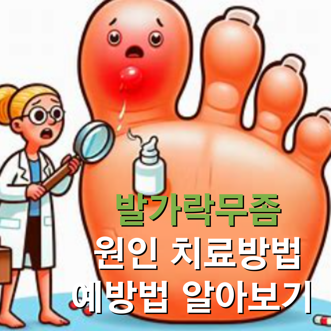 발가락 무좀 원인 치료방법 예방법