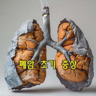 폐암 초기 증상