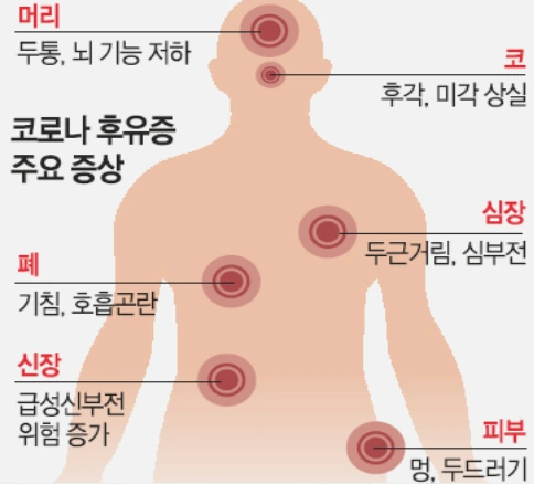 코로나 후유증
