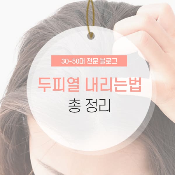 두피열 원인 및 내리는법 소개