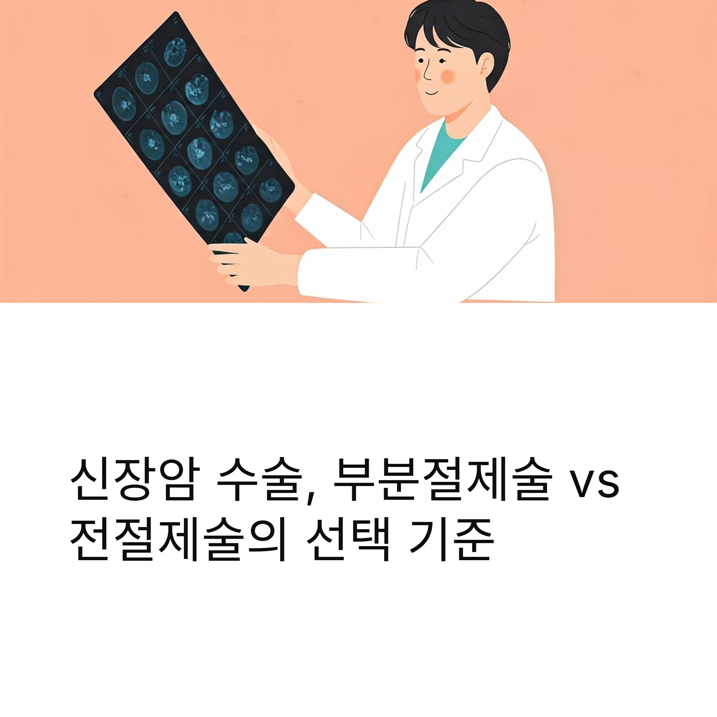신장암 절제술 선택기준 대표이미지