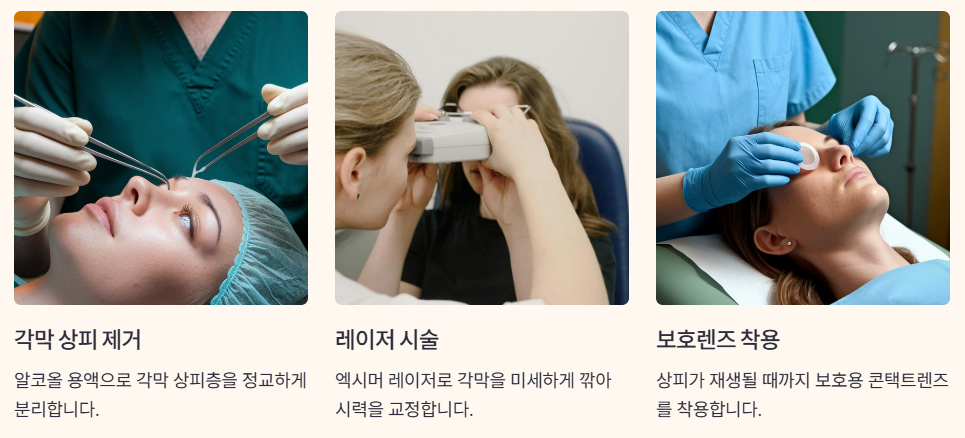 라섹수술과정