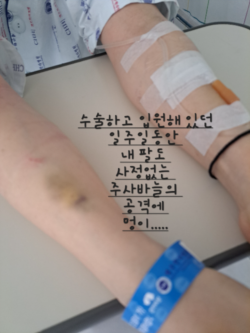 아킬레스건 완전 파열 후기2-병원 입원후 수술까지 과정과 비용