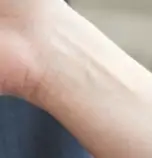 퇴직금과 퇴직연금의 핵심 차이점