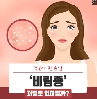 얼굴 비립종 없애는 법 자극 없이 제거하는 피부관리법_10