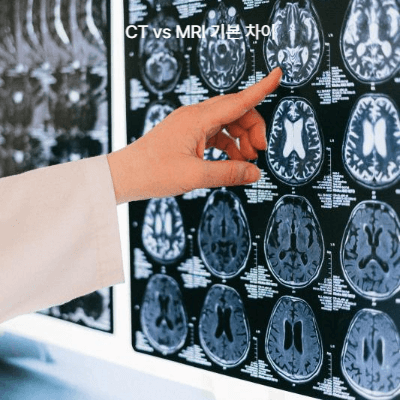 뇌 CT vs MRI 비교 (2025)｜검사 차이&middot;비용&middot;보험 적용 총정리