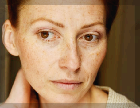 기미 없애는 법, 원인, 예방 및 관리