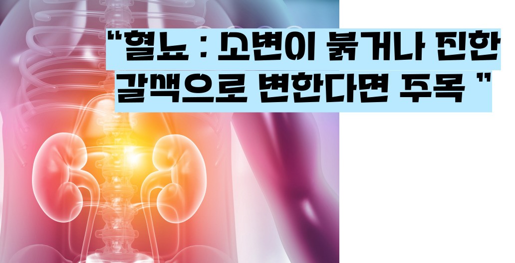 사구체신염 증상 원인