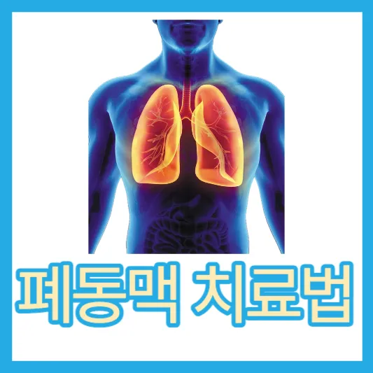 폐똥맥 돌연사 폐동맥고혈압 원인 증상 진단 검사 치료법