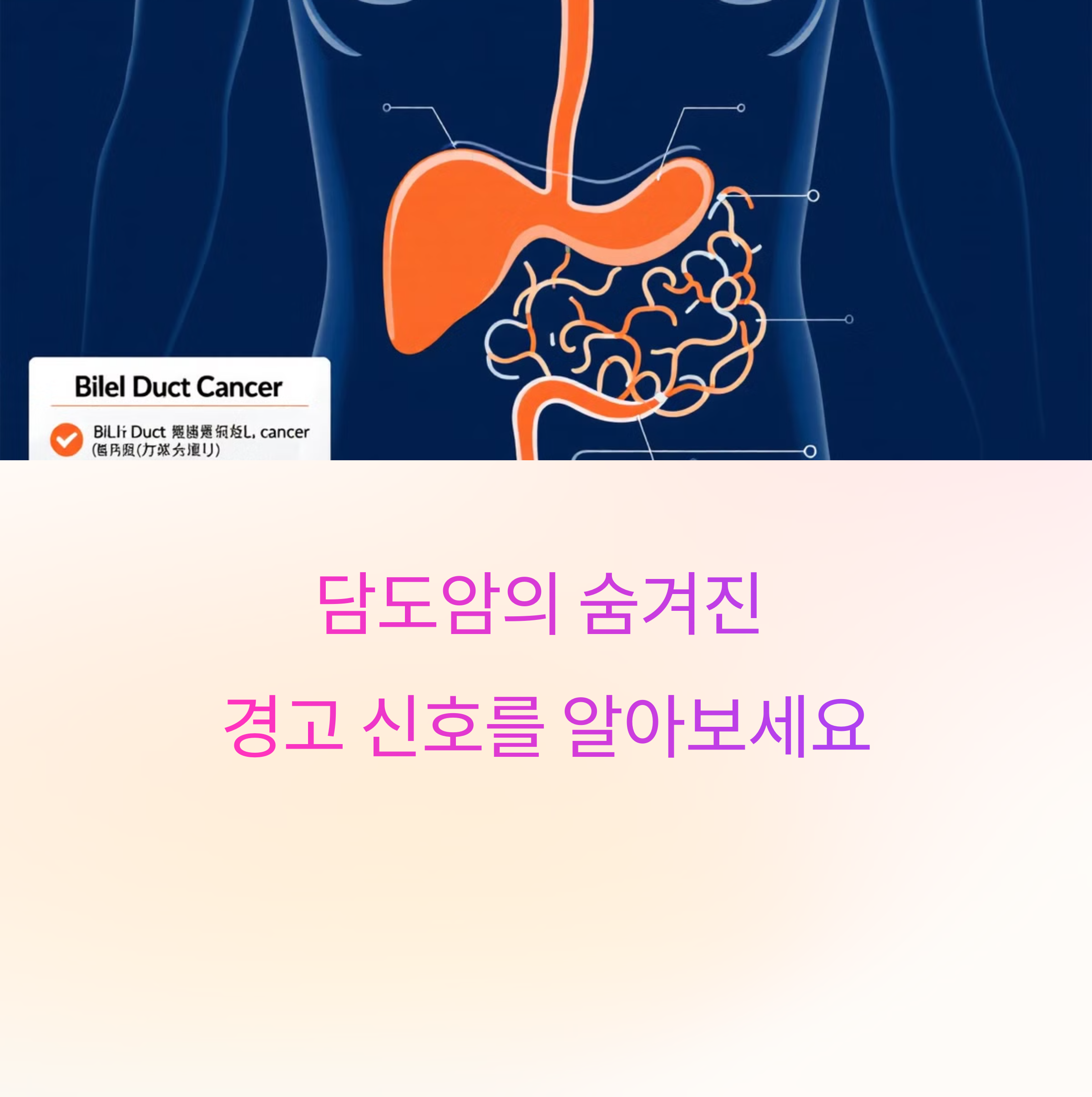 담도암 증상 초기단계 신호