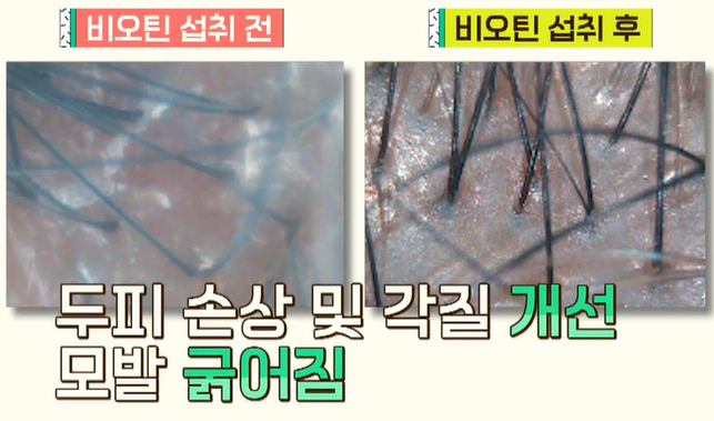 비오틴 효능