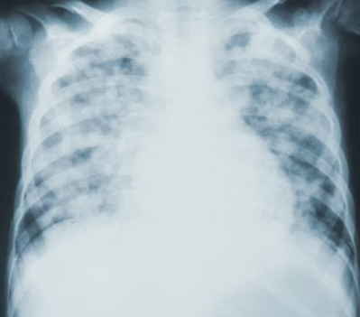 천식 증상 그대로 두면 위험하다 원인 예방법