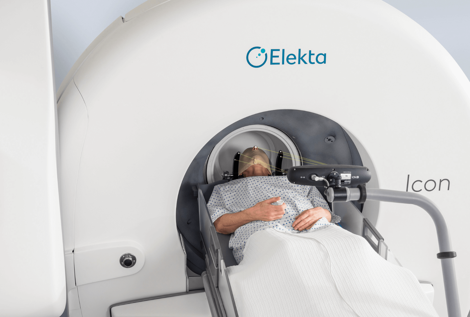 감마나이프 부작용