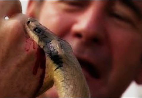 뱀에-물렸을때-응급처치