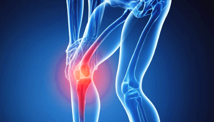 콘드로이친 효능 부작용