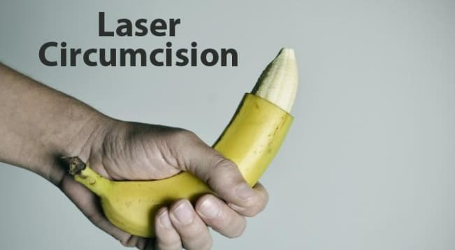 포경수술(Circumcision)은 꼭 받아야 하나?