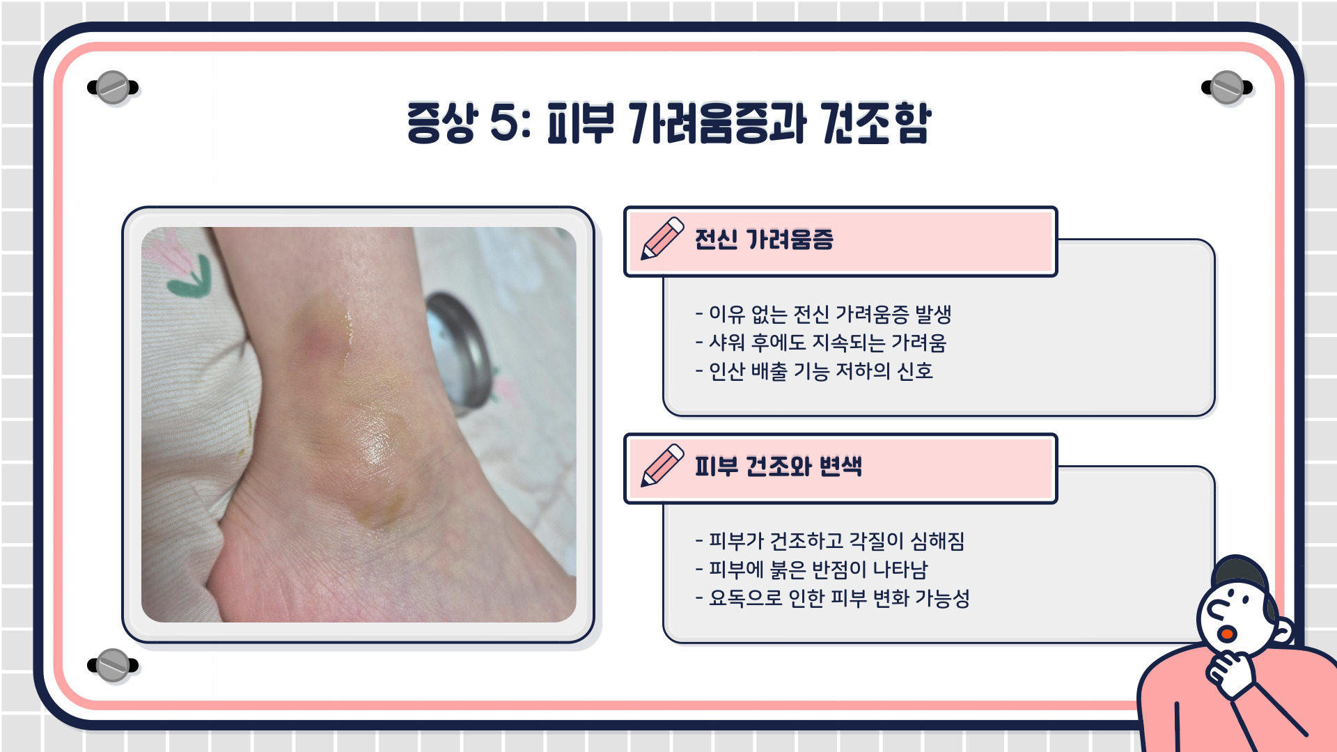 신장이 안좋으면 나타나는 증상