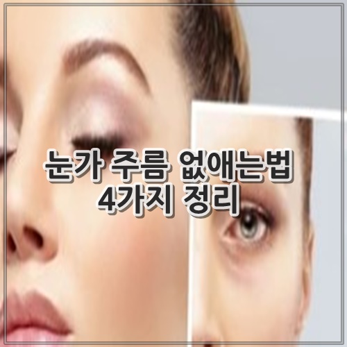 눈가 주름 없애는법 4가지 정리